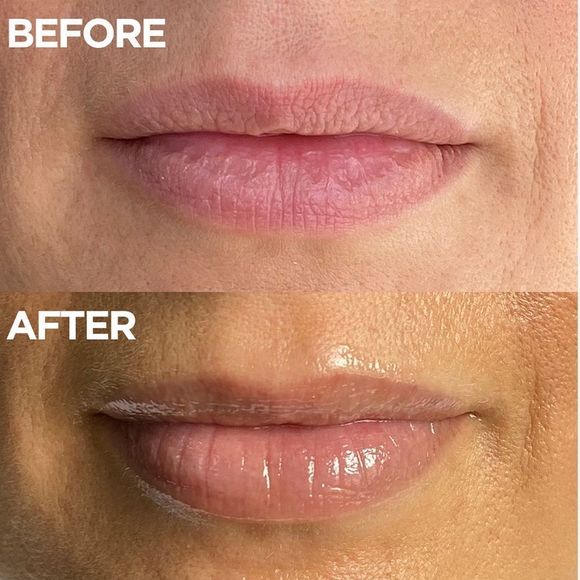 $13❤️‍🔥 LAST 1! Lano Lanolips The Original 101 Ointment Lip Balm Superbalm NEW - Picture 4 of 10